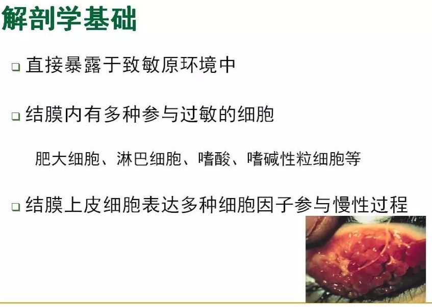 眼睛过敏如何预防,治疗眼周围过敏方法