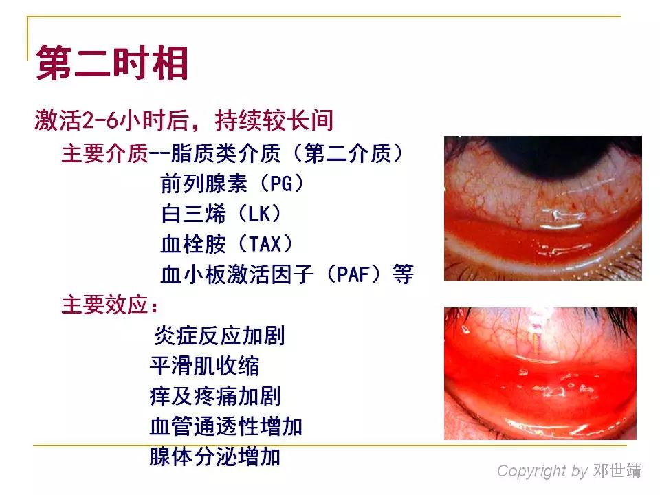 眼睛过敏如何预防,治疗眼周围过敏方法