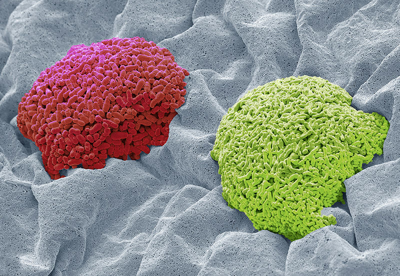 刚出生的婴儿细菌感染全身红疹,婴儿体内的细菌