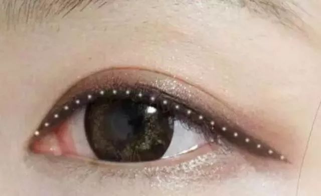 常州这种地方整容不失败才怪!2名女子为变美,一个差点眼瞎一个脸变猪头!