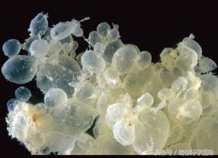 孕5-6周早期少量出血不要紧张,孕6周早期出血