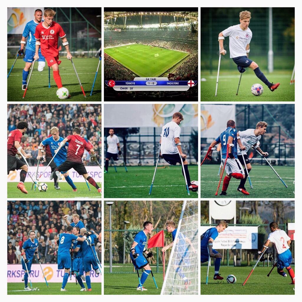 生命遭遇重大变故后，22岁英伦小伙诠释对足球的热爱