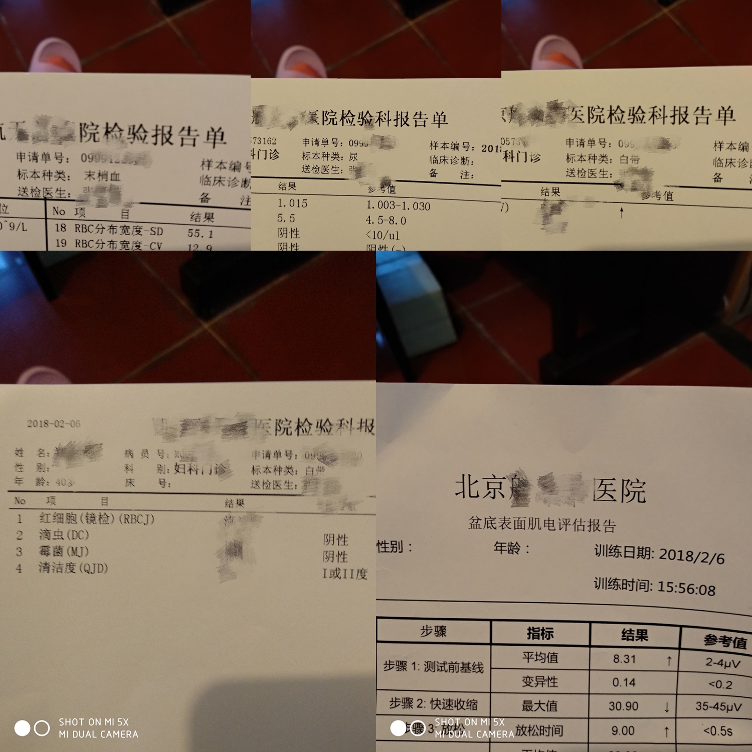 产后42天检查是做b超还是阴超,产后42天检查是免费还是自费的