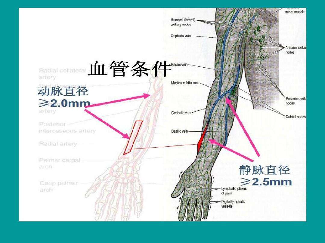 日常怎样保护内瘘,透析病人怎么保护内瘘