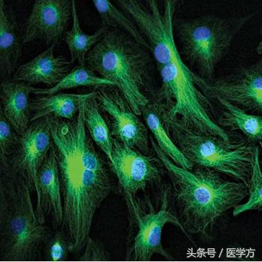 制作细胞爬片需要在细胞间做吗,细胞爬片操作步骤