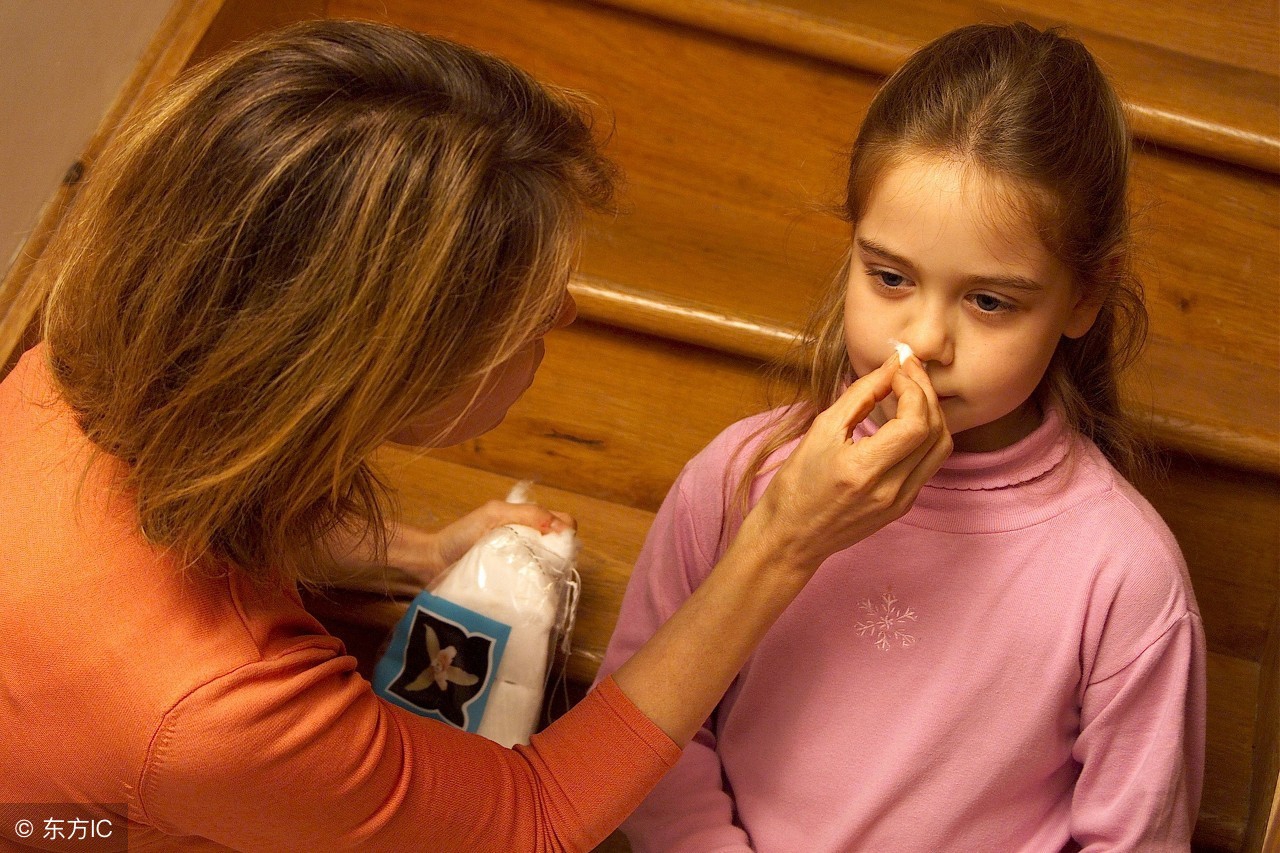 鼻出血勿仰头,鼻出血不要着急堵回去