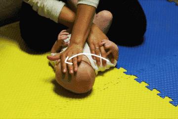 婴儿斜颈是不是必须要推拿,婴儿斜颈有必要治疗吗