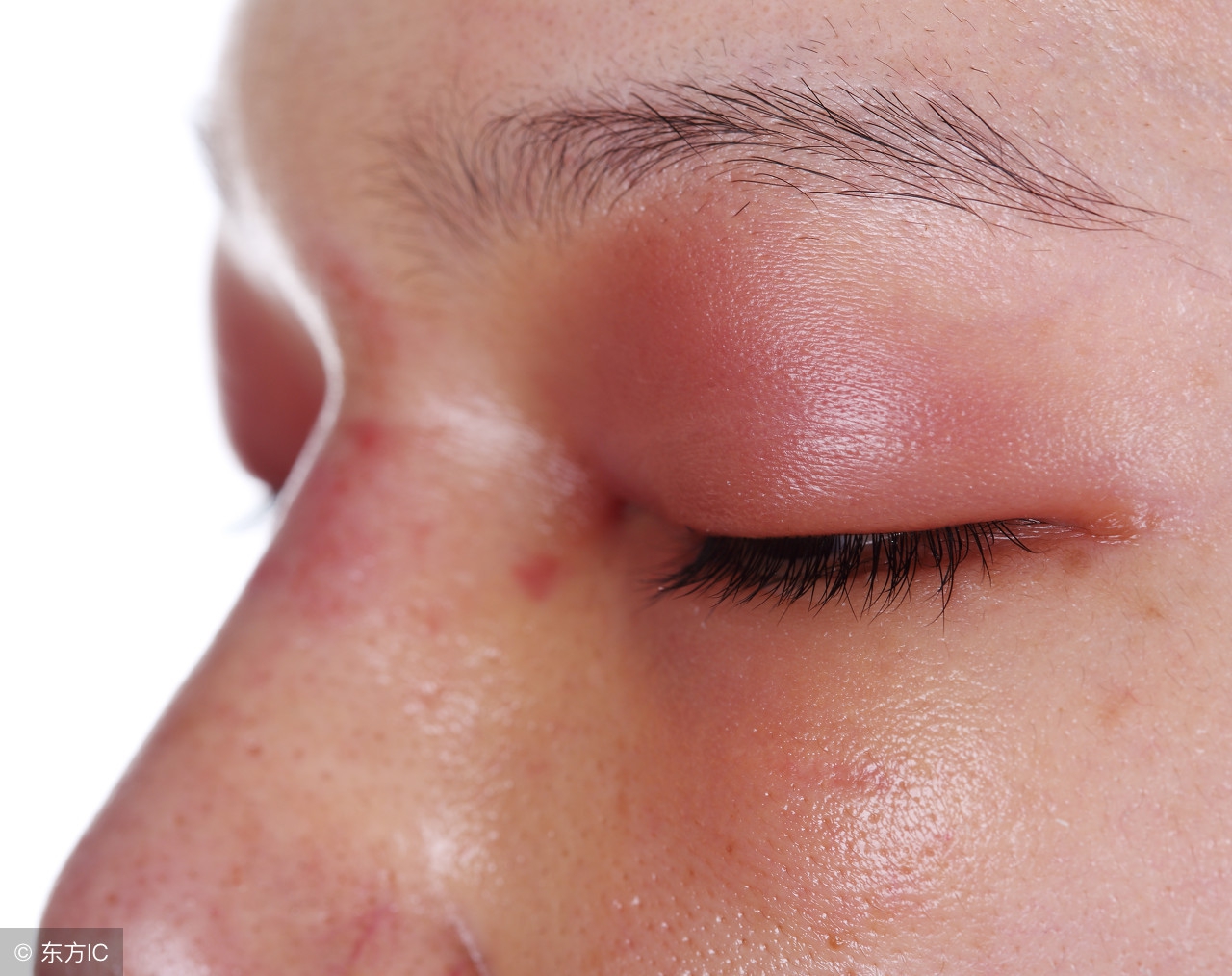 女人面色浮肿,女性脸部浮肿吃什么药