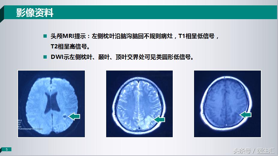 做了好多检查都正常就是发烧,做了好多检查都正常