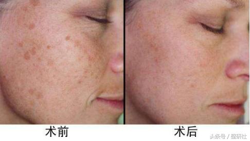 医美助力逆转修复,医美可以抵抗断崖式衰老吗