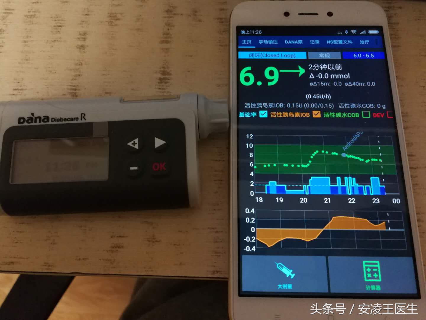 动态血糖曲线分析,血糖数据预测算法