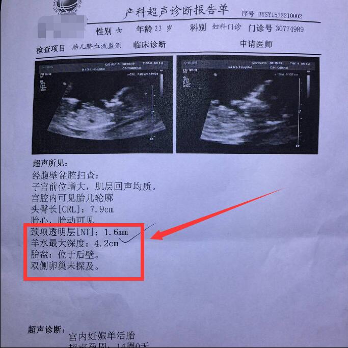 孕期检查的猫腻,孕期胎动的秘密