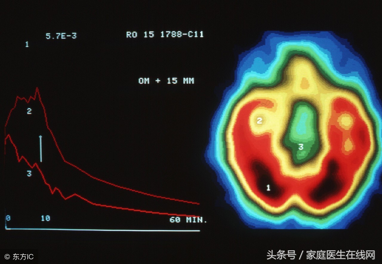 什么情况下会出现抽搐癫痫的现象,抽搐是癫痫吗癫痫如何预防