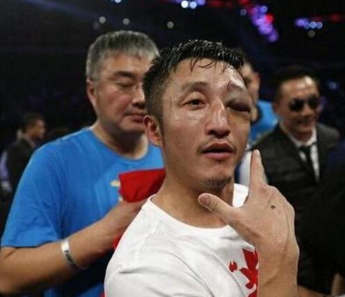 邹市明眼睛恢复视频,拳王邹市明眼睛受伤视频