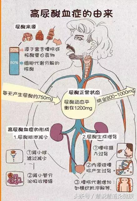 喝茶和咖啡哪个尿酸高,喝茶多会引起尿酸高吗