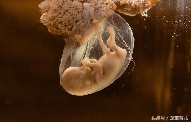 胎儿在肚子里面吃喝拉撒咋办,胎儿粪便进入羊水里是什么原因