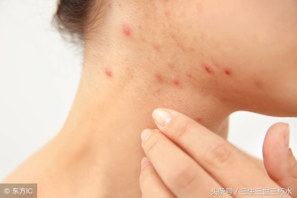 孕期可以吃的海鲜有哪些,孕期血糖高可以吃海鲜吗