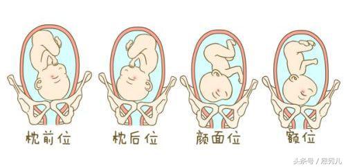 每一位孕妈都有进行顺产的条件，只要你注意这几个方面！