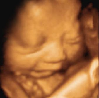 四维胎宝宝笑,宝宝在妈妈肚子里四维的全过程