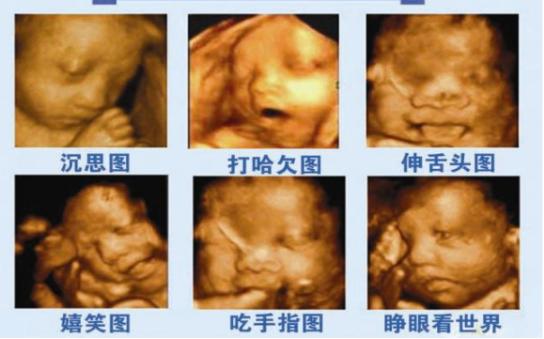 四维胎宝宝笑,宝宝在妈妈肚子里四维的全过程