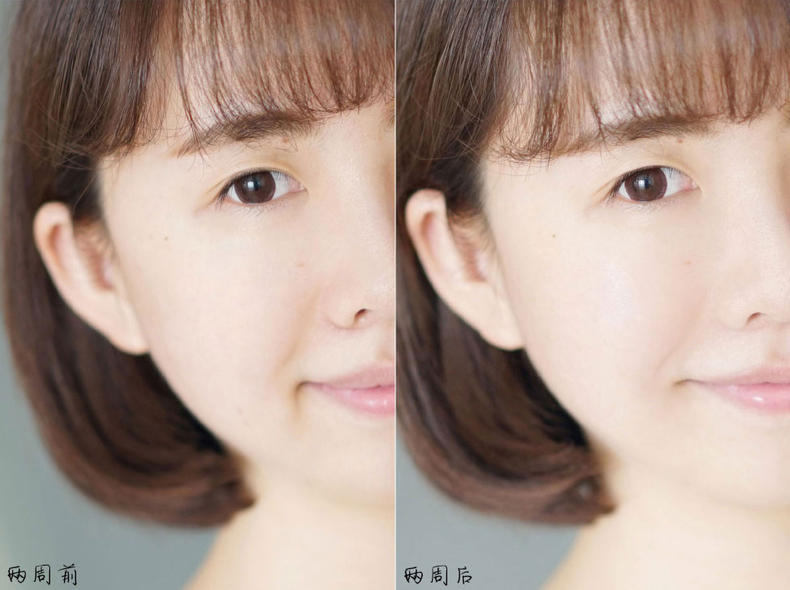 祛黄提亮和美白是一样的吗,33岁熬夜暗黄用哪款精华抗老