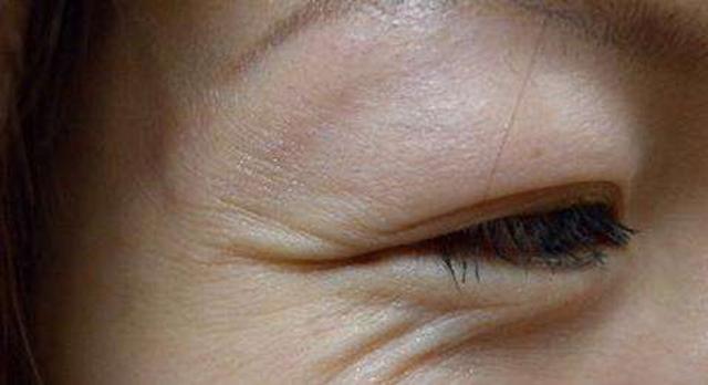 黑眼圈眼纹眼袋是怎么来的,黑眼圈眼袋眼纹问题