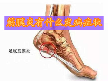 背部筋膜炎的6大表现症状,腰背筋膜炎症状及治疗方法