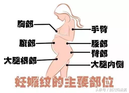 什么霜和油预防妊娠纹最好,娇韵诗妊娠纹油和霜