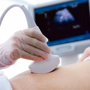 胎儿b超拍照,孕期b超留念