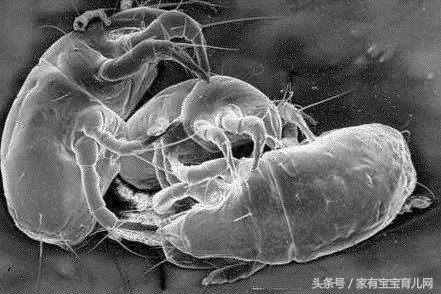 宝宝肚子里有蛔虫怎么观察,怎么预防宝宝肚子里有蛔虫