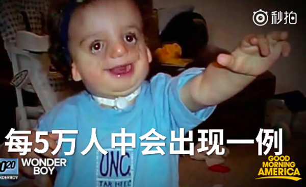 神奇化妆术男生,奇迹男孩应用