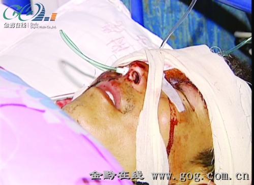 小孩眼睛被鞭炮炸伤,眼睛被鞭炮炸伤了怎么办