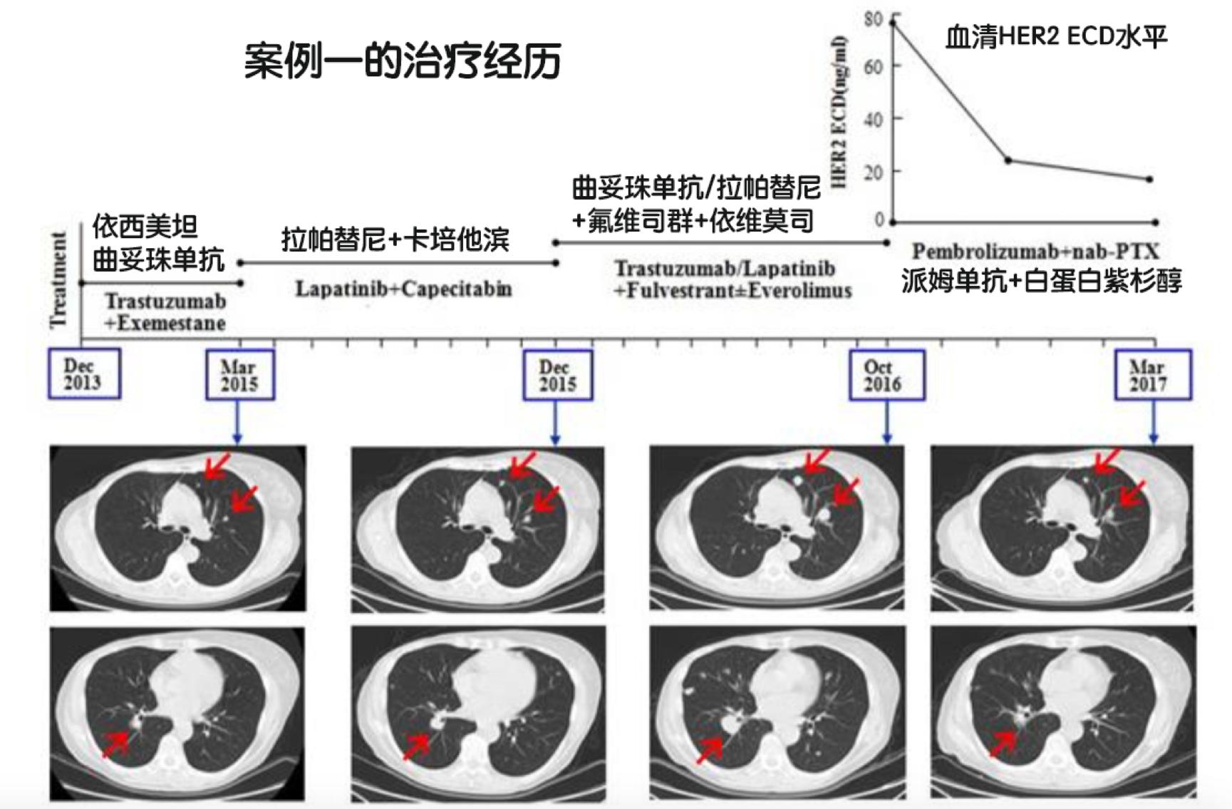 乳腺癌靶向药不耐药还会骨转移吗,乳腺癌肝转移靶向药耐药时间