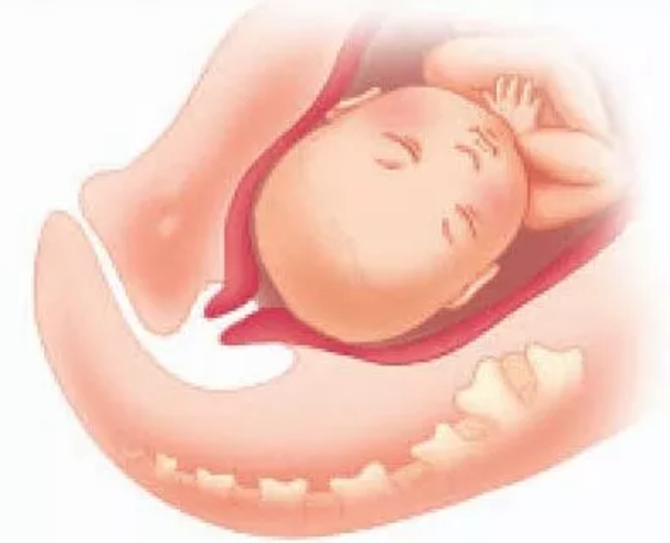 经产妇第一产程时间,准妈妈必知顺产5大良方