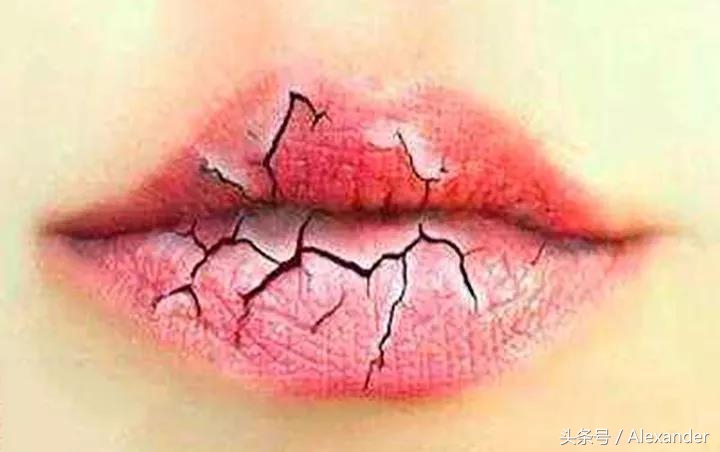 嘴唇脱皮干裂用什么唇膏,冬天嘴唇干裂没有唇膏怎么办