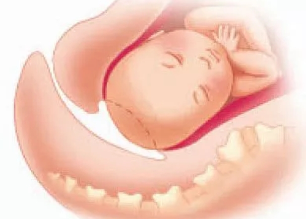 经产妇第一产程时间,准妈妈必知顺产5大良方