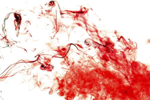 妇科医生：这种阴道出血要小心，别忽视宫颈癌！