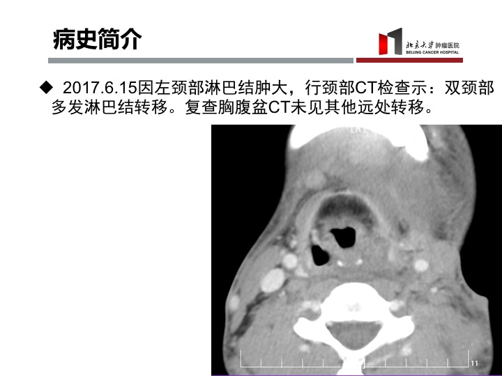 黑色素瘤怎么判定几期,黑色素瘤深度达到多少可以治愈