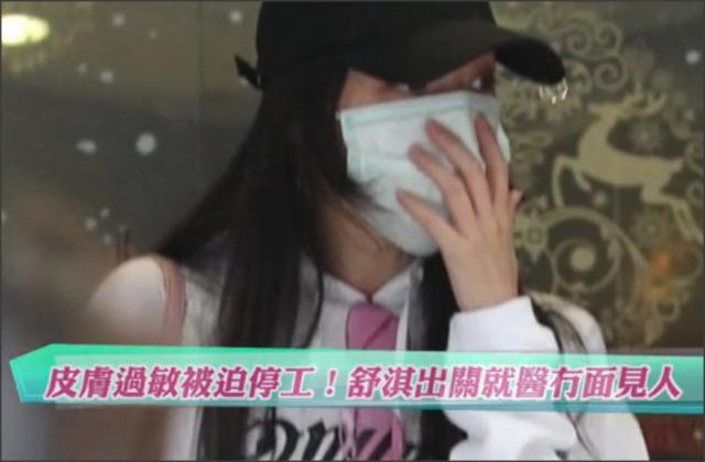 舒淇过敏都用什么护肤品呢,紫外线过敏舒淇