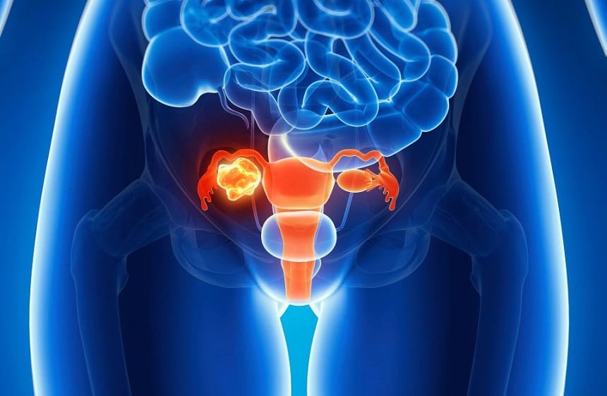 妇科医生：这种阴道出血要小心，别忽视宫颈癌！