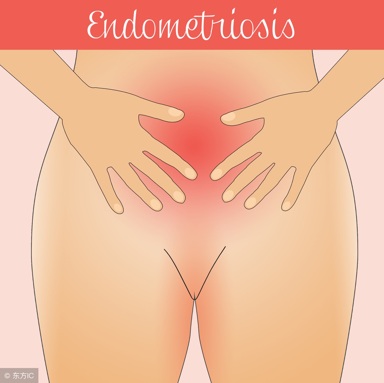 子宫内膜息肉手术后感染症状,老年人子宫内膜息肉的症状