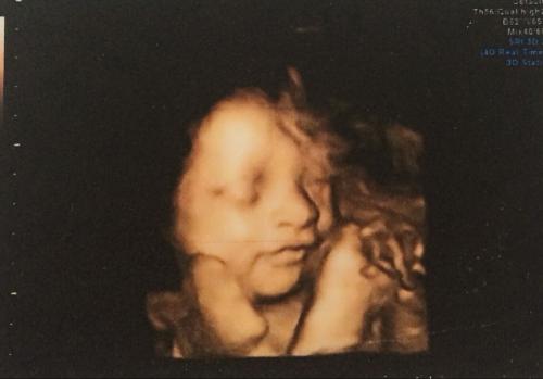 做三维和做四维有什么区别哪个好,二维三维四维该做哪一个