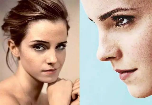 面部常见四类斑点如何正确祛斑,斑点在脸上该怎么去除