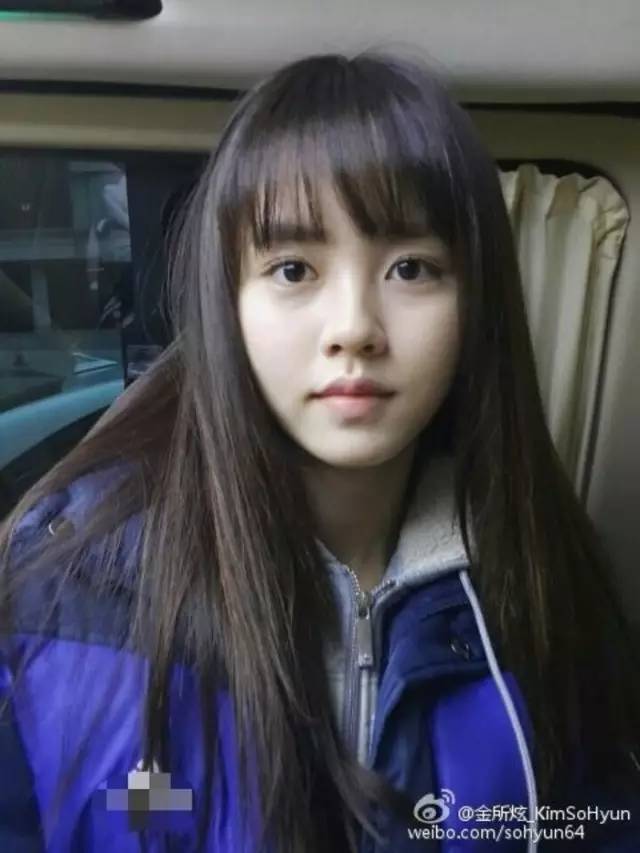 刘海儿为什么爱出油,儿童刘海出油怎么办