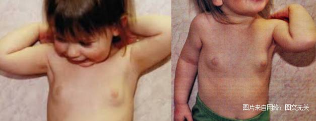 2岁女孩来月经怎么回事,12岁女童来例假前兆