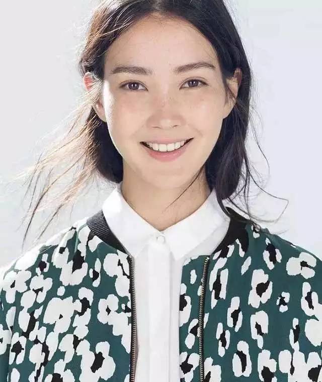 面部常见四类斑点如何正确祛斑,斑点在脸上该怎么去除