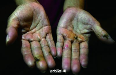 关注环卫工,关注身边的环卫工