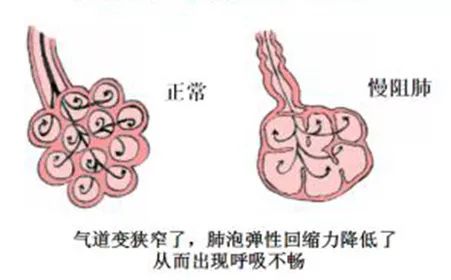 难受死了怎么办,难受死了睡不着怎么办
