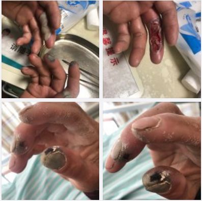 关注环卫工,关注身边的环卫工