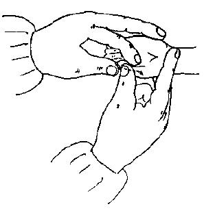 宝宝面黄是由什么原因引起的,儿童面色萎黄消瘦无血色